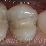 Show Your Patient the Problem with Pictures