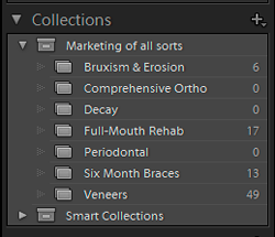 Photoshop Lightroom Collections make it easy to set aside and work with select photos to use.
