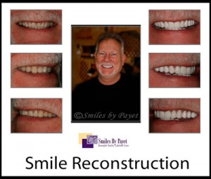 See an example poster of a FMR for a dental website.